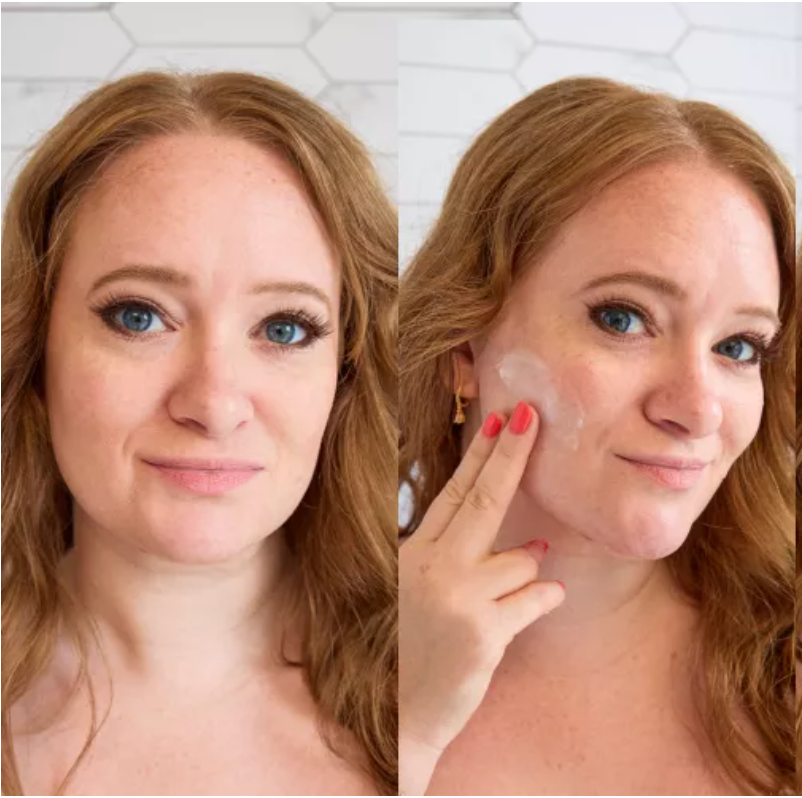 Beyond The Hype: Why Face Oils Are A Must For Sensitive Skin